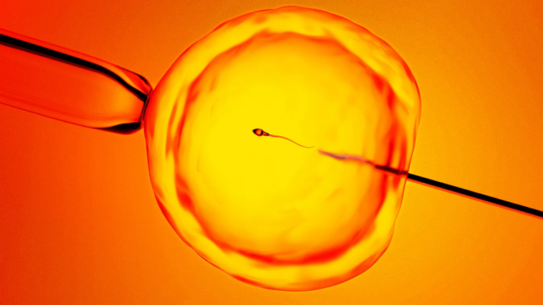 Finding ‘Hidden Sperm’: New Technique Offers Hope To Men Previously Told They Were Infertile