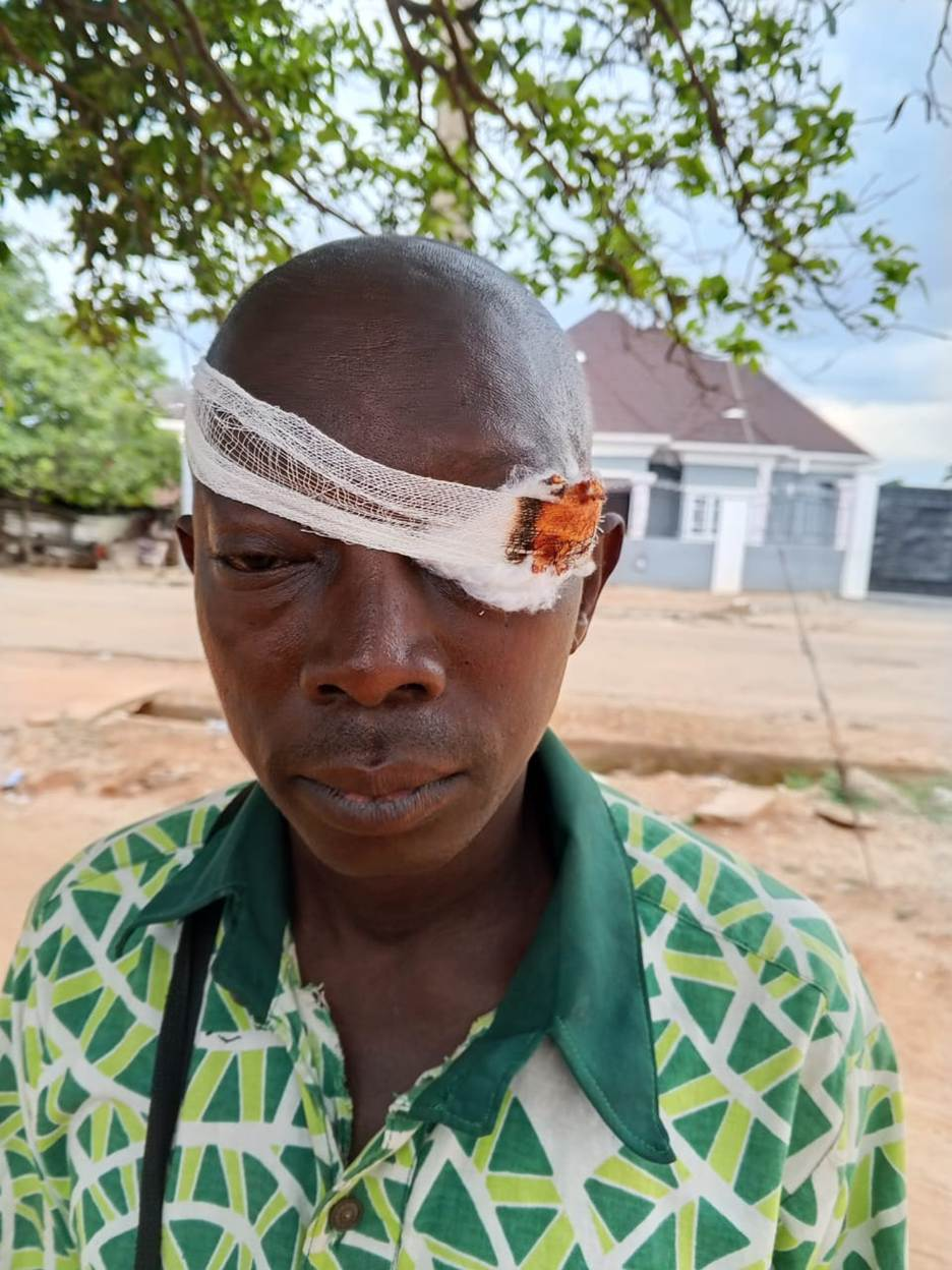 APC Member In Ekiti Beaten to Coma During House Of Reps Primary As Thugs Attack Venue