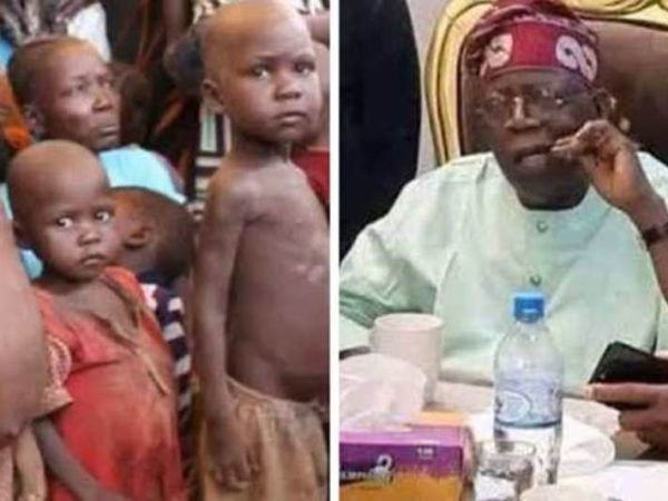 Nigeria Emerges Africa’s Capital of Malnourished Children, Overtaking War-Torn Sudan – UNICEF Report
