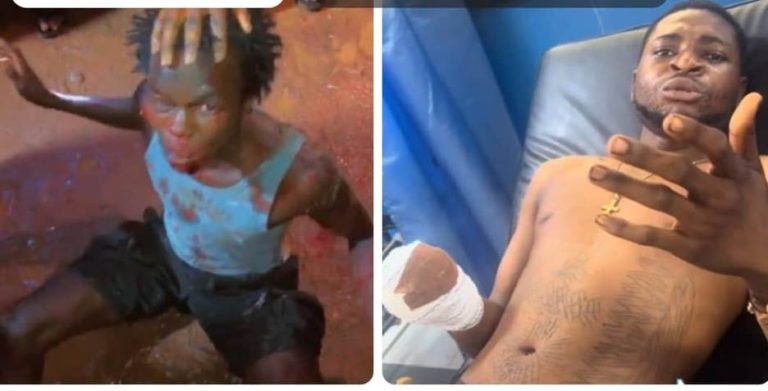 Falsely Accused Victim of Mob Action Whose Hand Was Amputated Cries Out For Justice As Edo Police Take Up Case Falsely Accused Victim of Mob Action Whose Hand Was Amputated Cries Out For Justice As Edo Police Take Up Case
